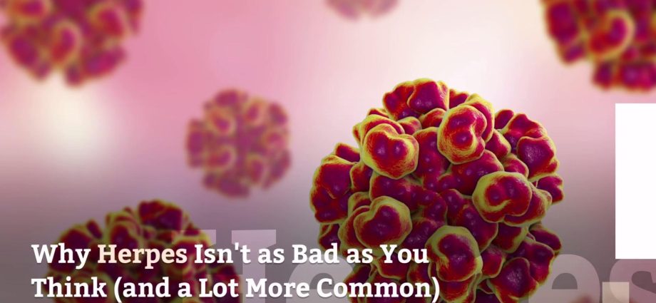 Herpes is more dangerous than you think