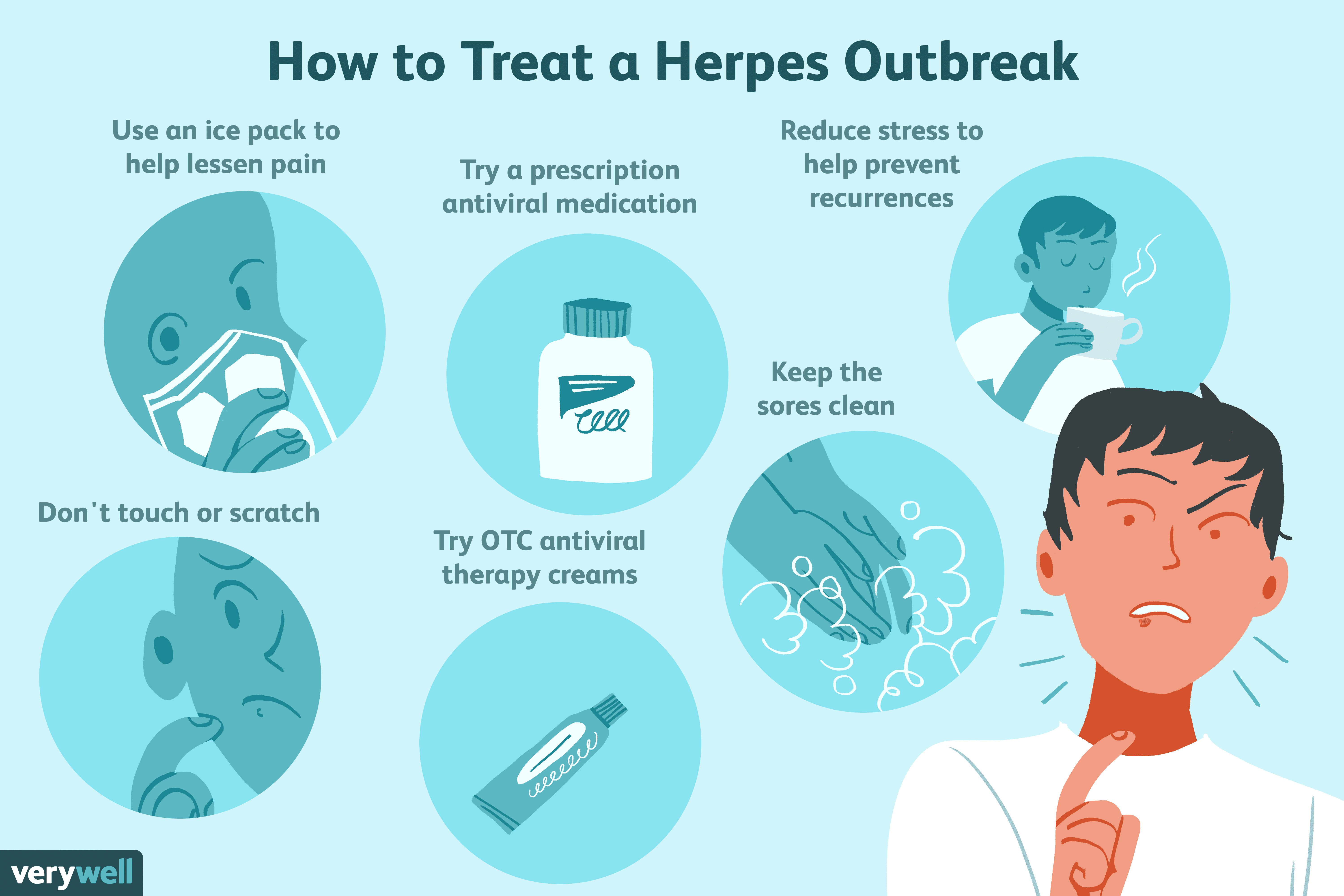 Herpes Symptoms And Treatment 