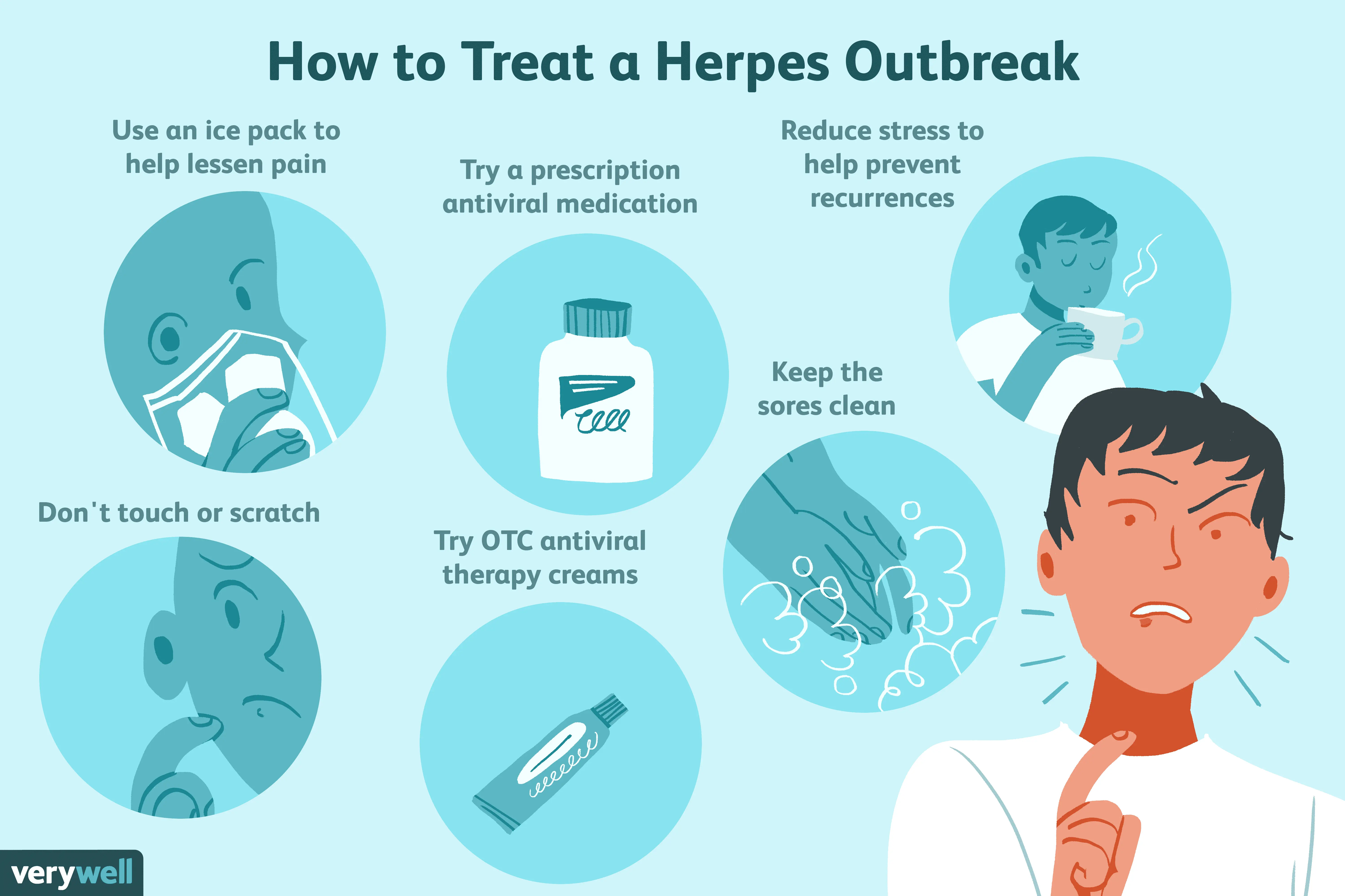 Will Herpes Outbreaks Lessen Over Time