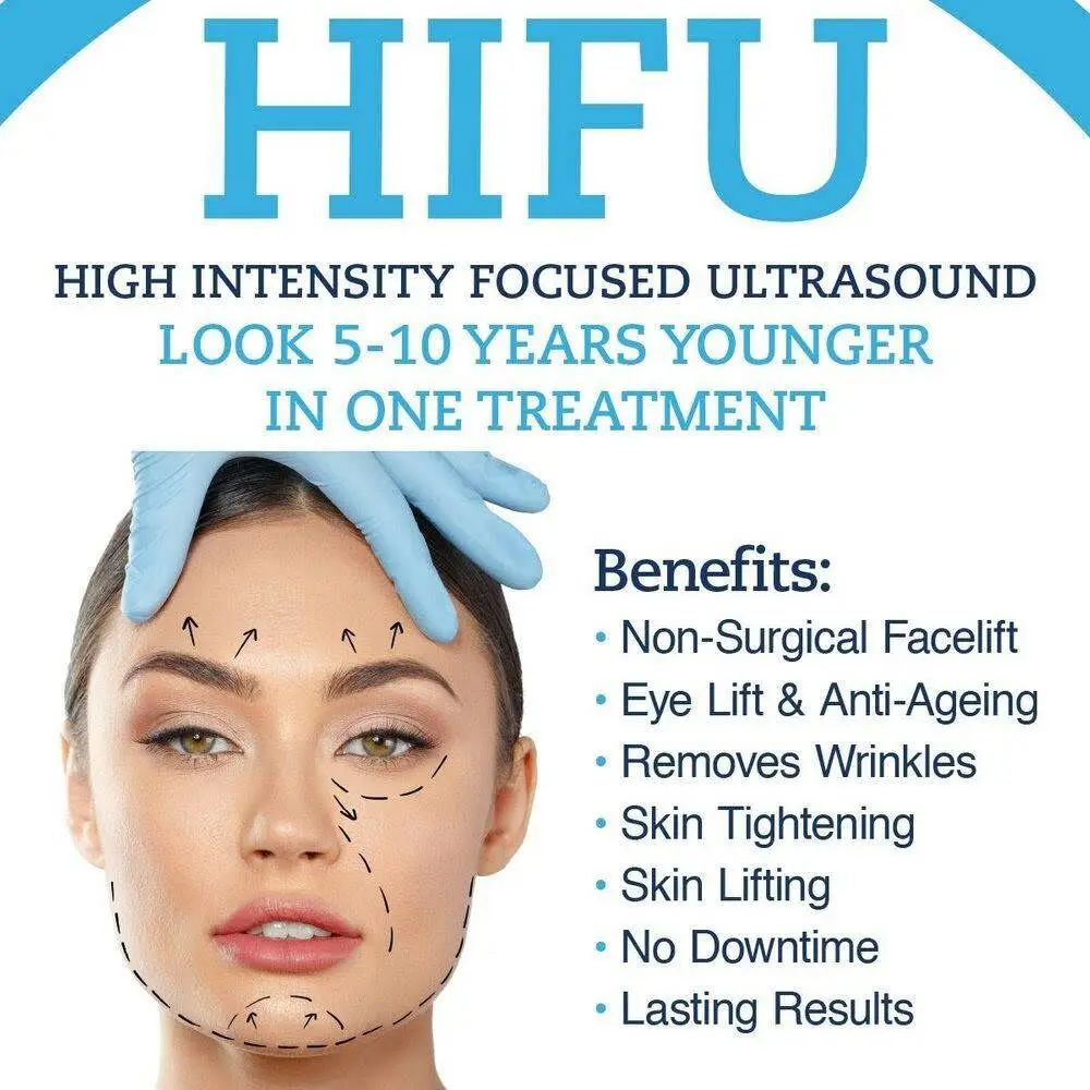 HIFU treatment &#8211; application, contraindications, effects. A way to lose weight and more