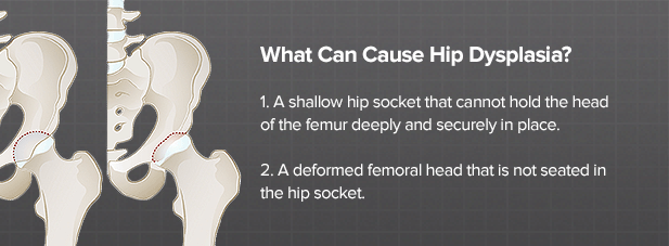 Hip dysplasia is not a sentence