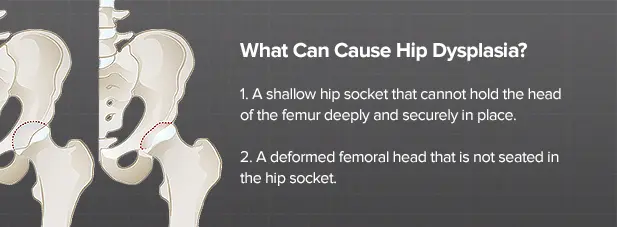 Hip dysplasia is not a sentence