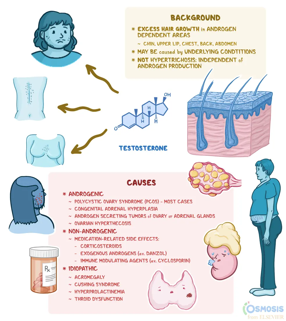 Hirsutism &#8211; causes, symptoms, treatment