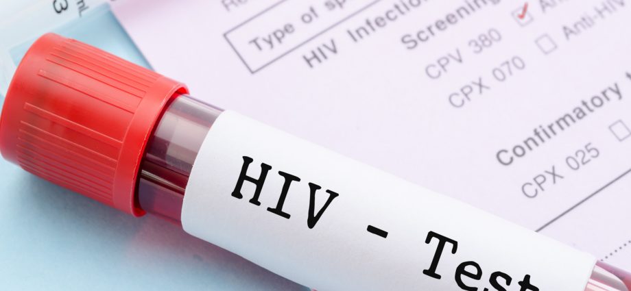 HIV testing