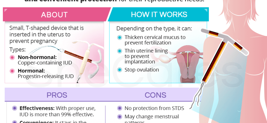 Hormonal IUD &#8211; is it effective in preventing pregnancy?