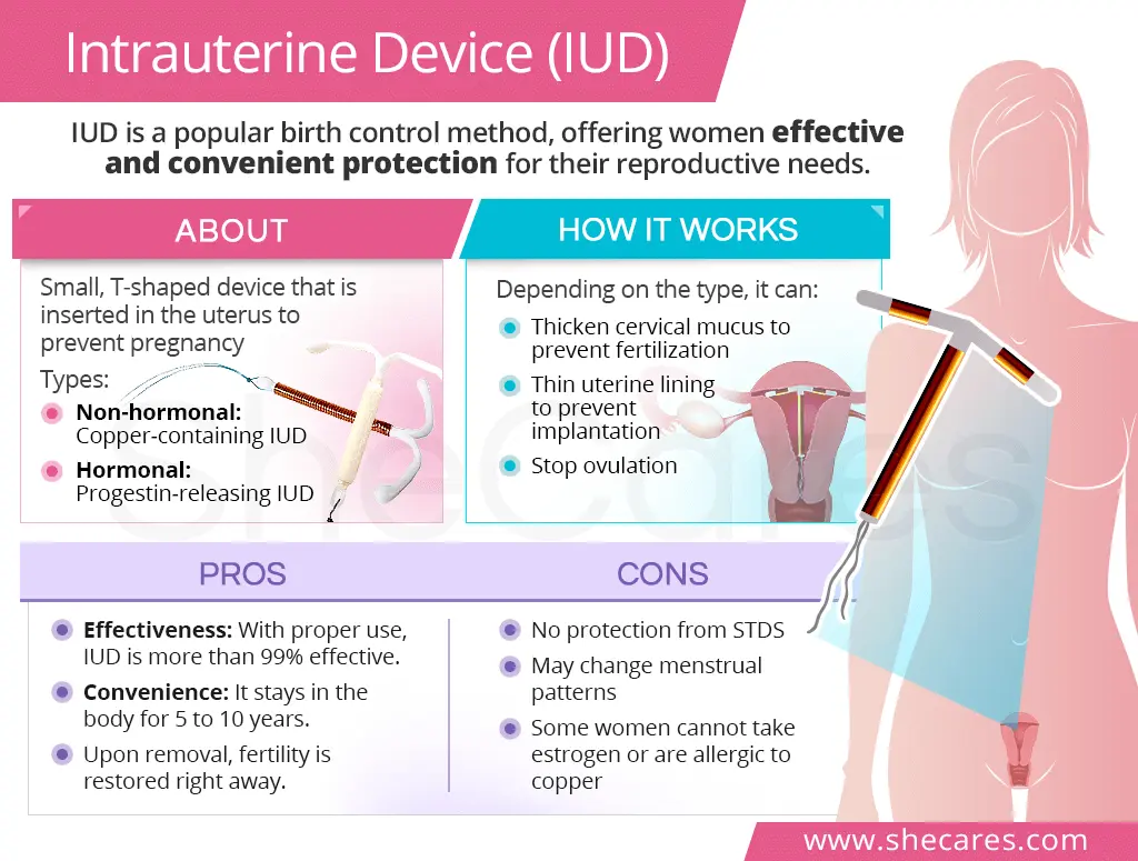 Hormonal IUD &#8211; is it effective in preventing pregnancy?