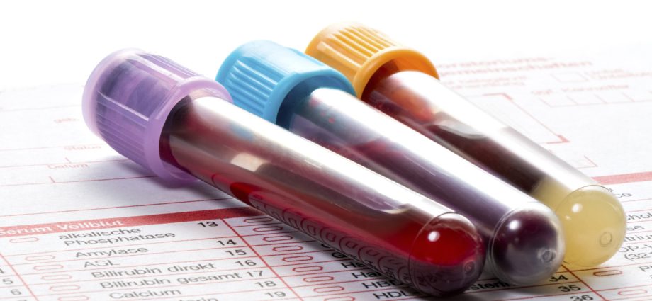 How can I improve my blood test results? These changes have spectacular effects