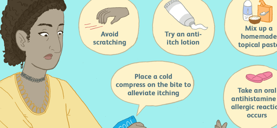 How can I prevent mosquito bites from itching? Doctor&#8217;s advice