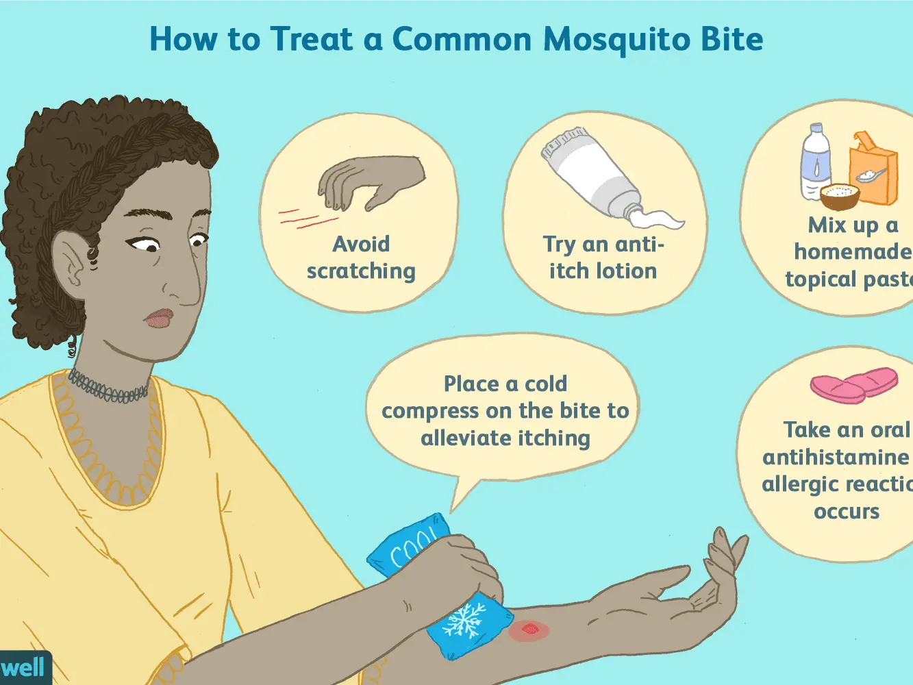 How can I prevent mosquito bites from itching? Doctor&#8217;s advice