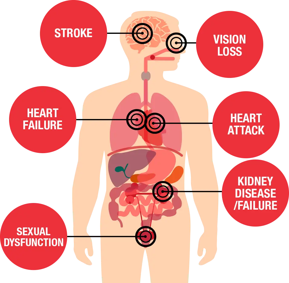 How do you know if you have high blood pressure? Here are five signs that it&#8217;s not good