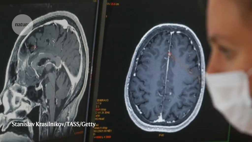 How does COVID-19 damage the brain?