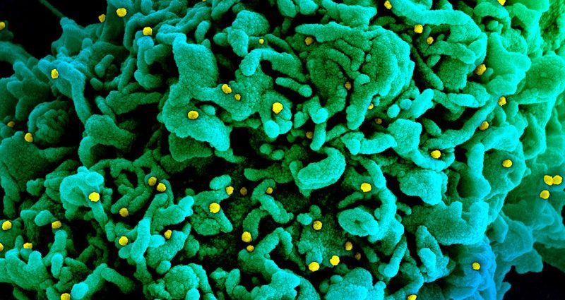 How does the coronavirus attack the body? The scientists answer