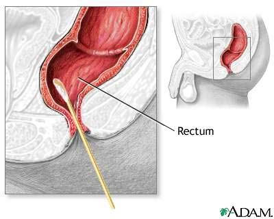 How is a rectal swab taken?