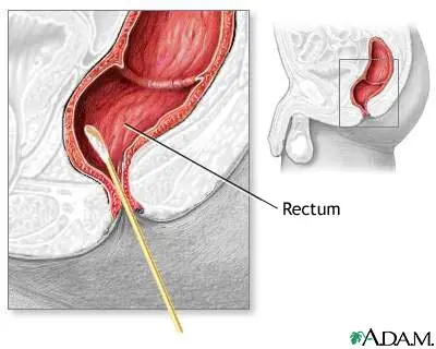 How is a rectal swab taken?