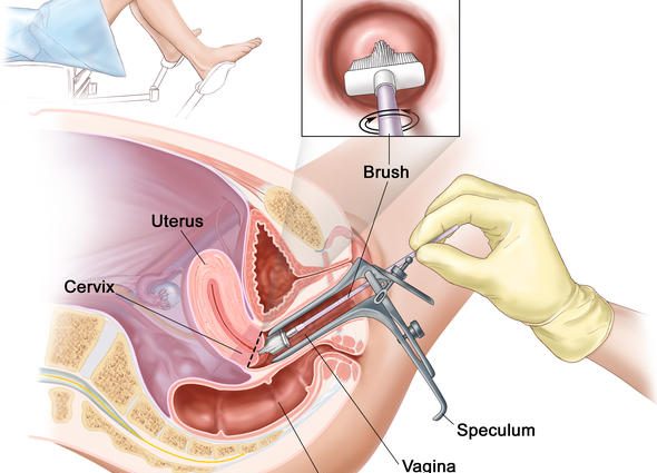 How is cervical cancer diagnosed?