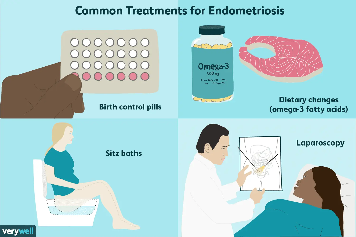 How is endometriosis treated?