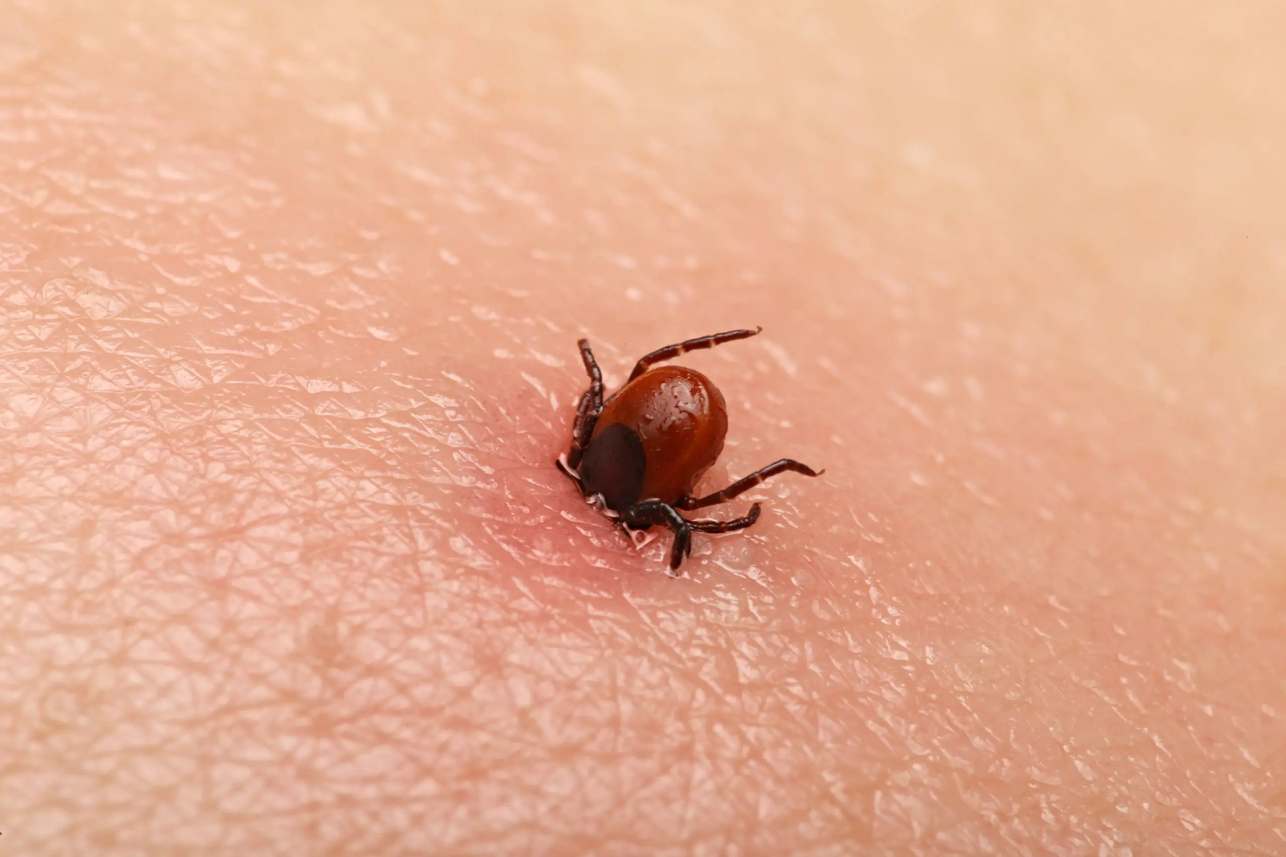 How many ticks can you catch in an hour? The result of the experiment is shocking