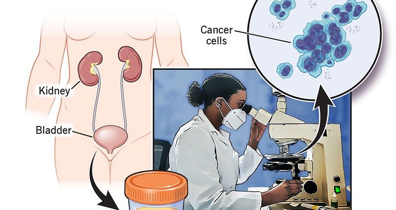 How should a cytology be performed?