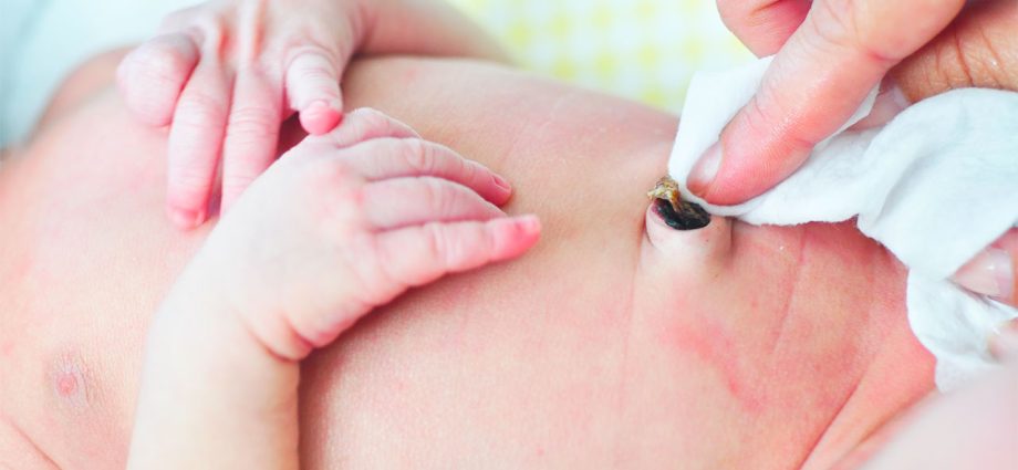 How to care for a newborn&#8217;s navel?