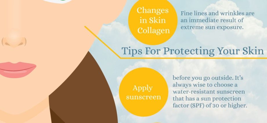 How to care for dry skin after sunbathing. We advise