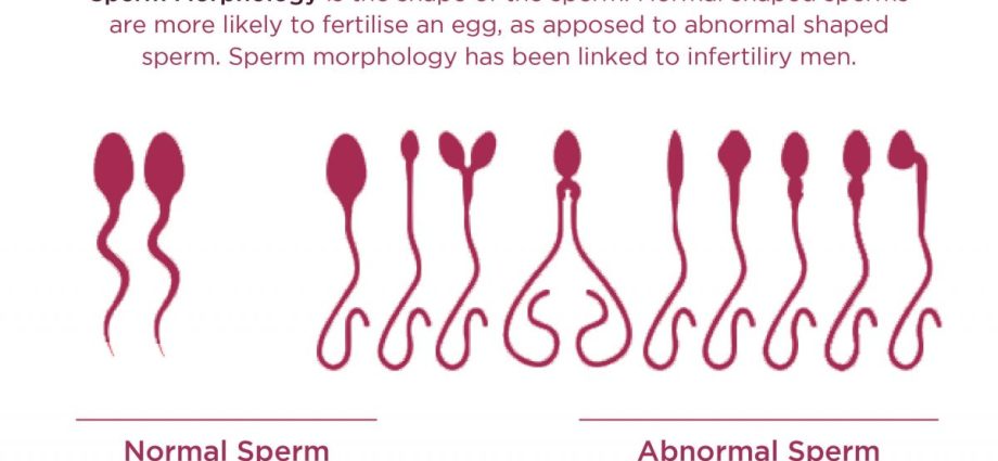 How to read the morphology results?