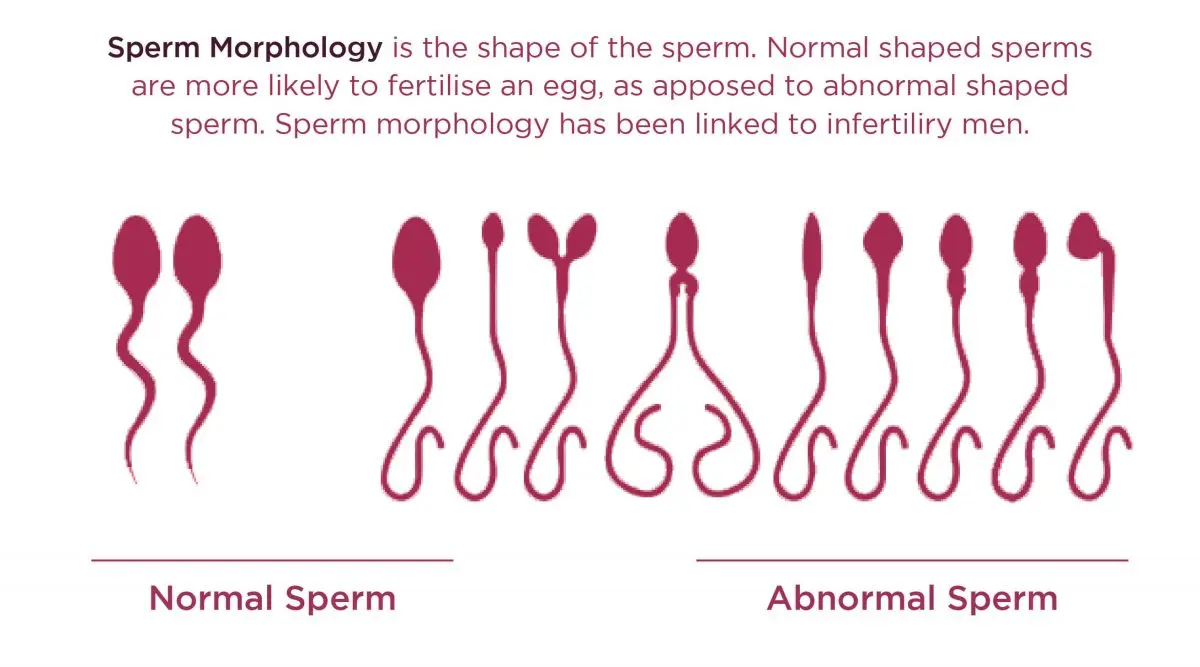 How to read the morphology results?