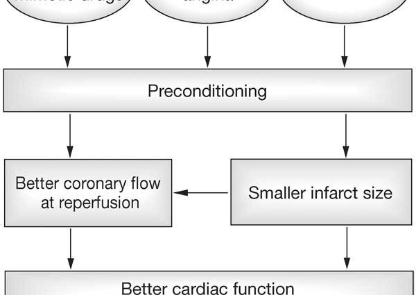 How to recognize a pre-infarction condition?