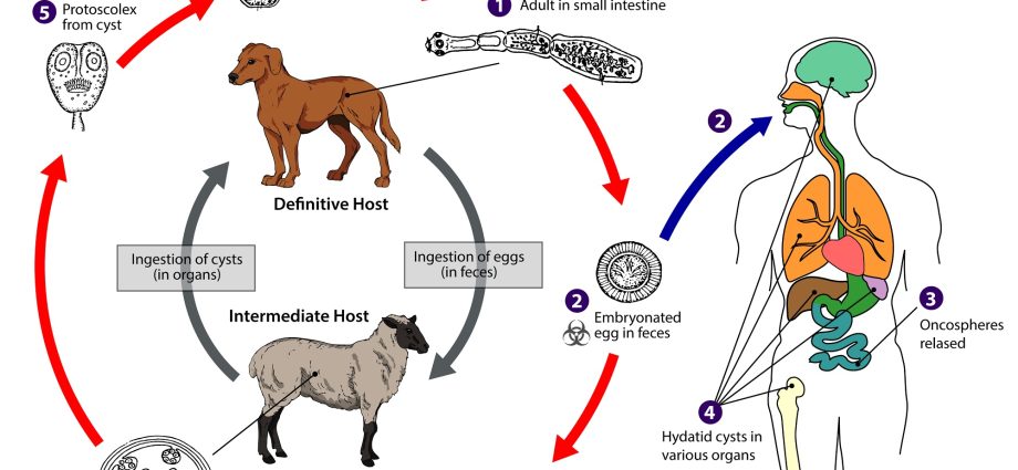 How to recognize the symptoms of echinococcosis?