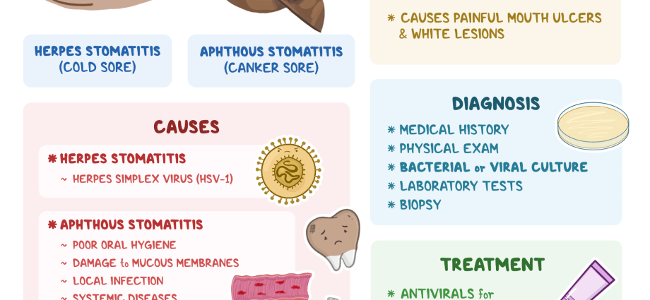 How to relieve stomatitis?