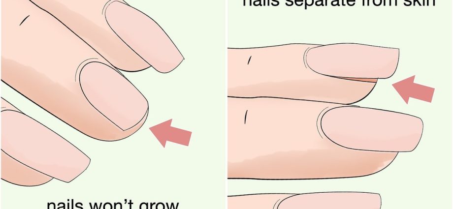 How to strengthen nails?