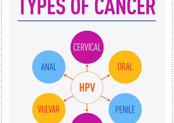 HPV virus &#8211; causes six types of cancer. Infection affects up to 80 percent. adults