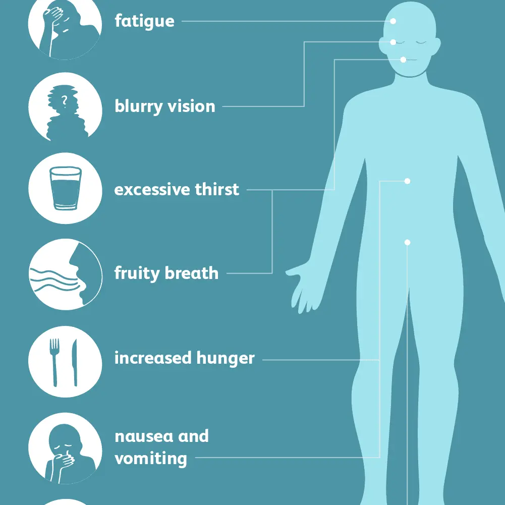 Hyperglycemia &#8211; causes, symptoms, treatment