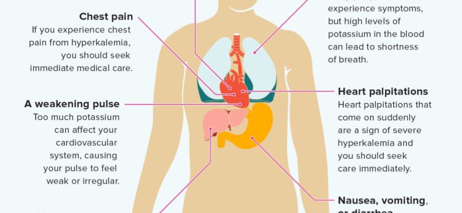 Hyperkalemia &#8211; causes, symptoms, treatment