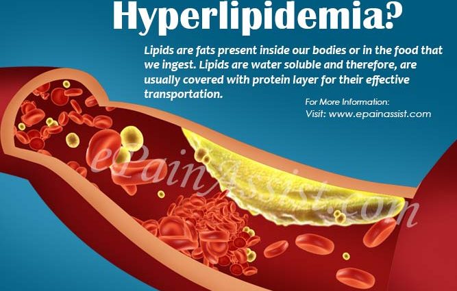 Hyperlipidemia &#8211; types, causes, symptoms, treatment, diet [EXPLAINED]