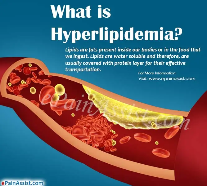 Hyperlipidemia &#8211; types, causes, symptoms, treatment, diet [EXPLAINED]