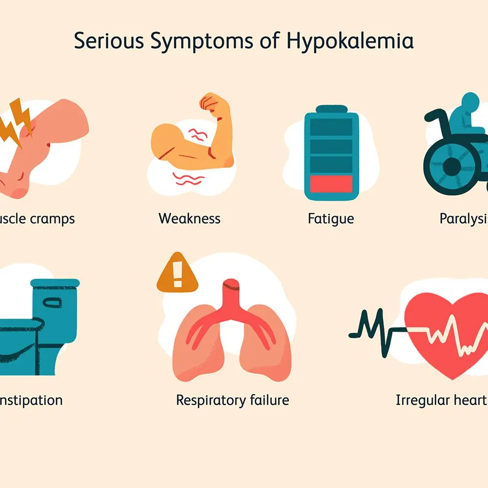 Hypokalemia &#8211; potassium deficiency, its causes and symptoms