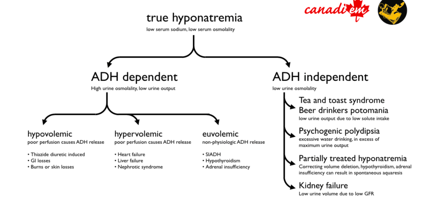 Hyponatraemia &#8211; what is it, what causes it, how is it recognized and treated?