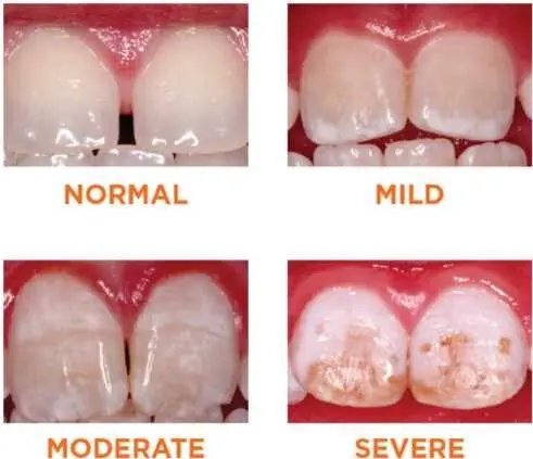 Hypoplasia &#8211; what is it? What are the dangers?