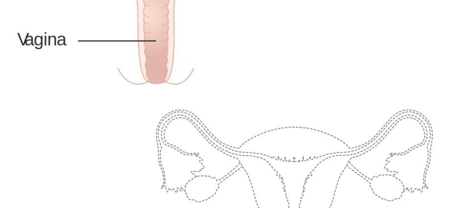 Hysterectomy &#8211; what is it? When is a hysterectomy used?