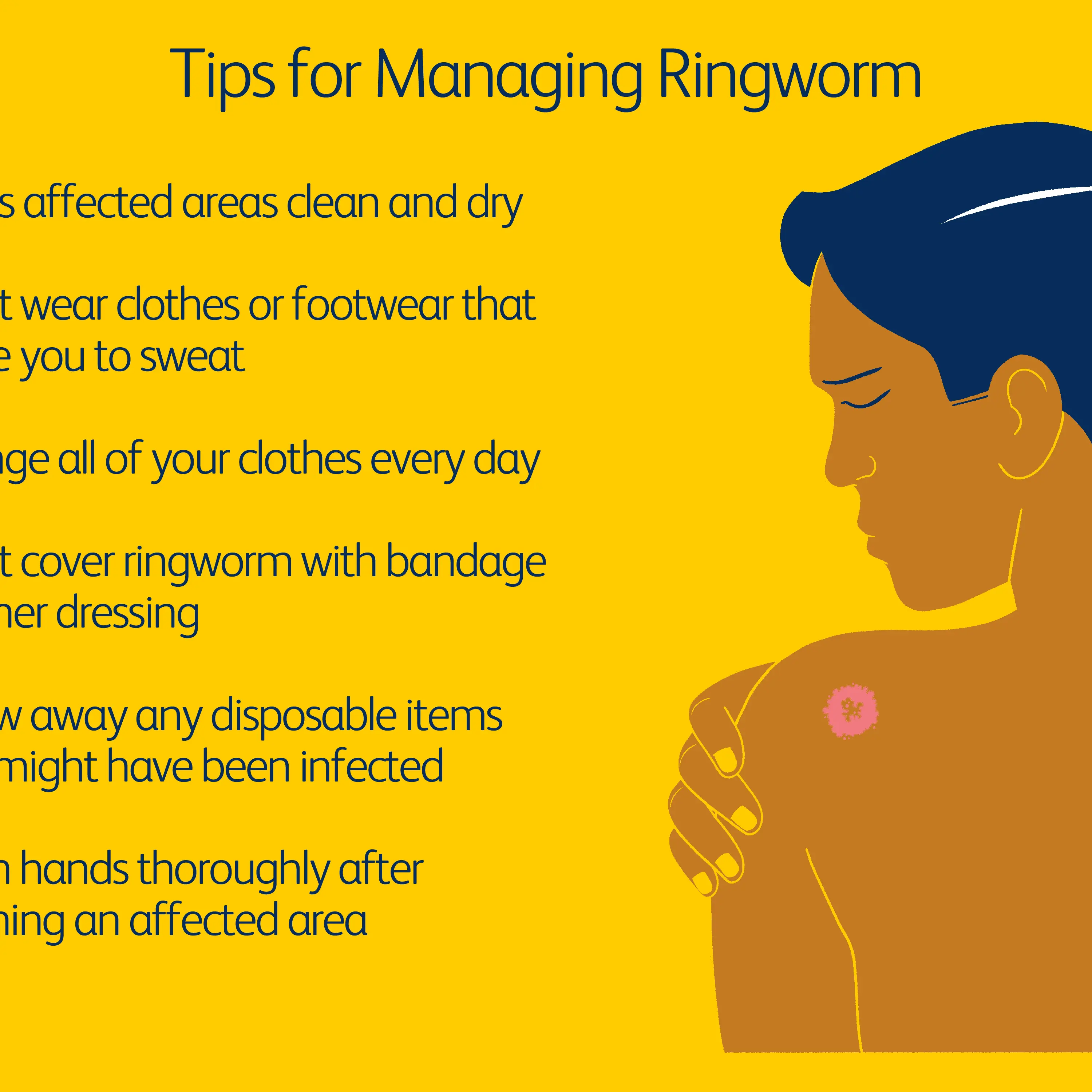 I can&#8217;t cure ringworm