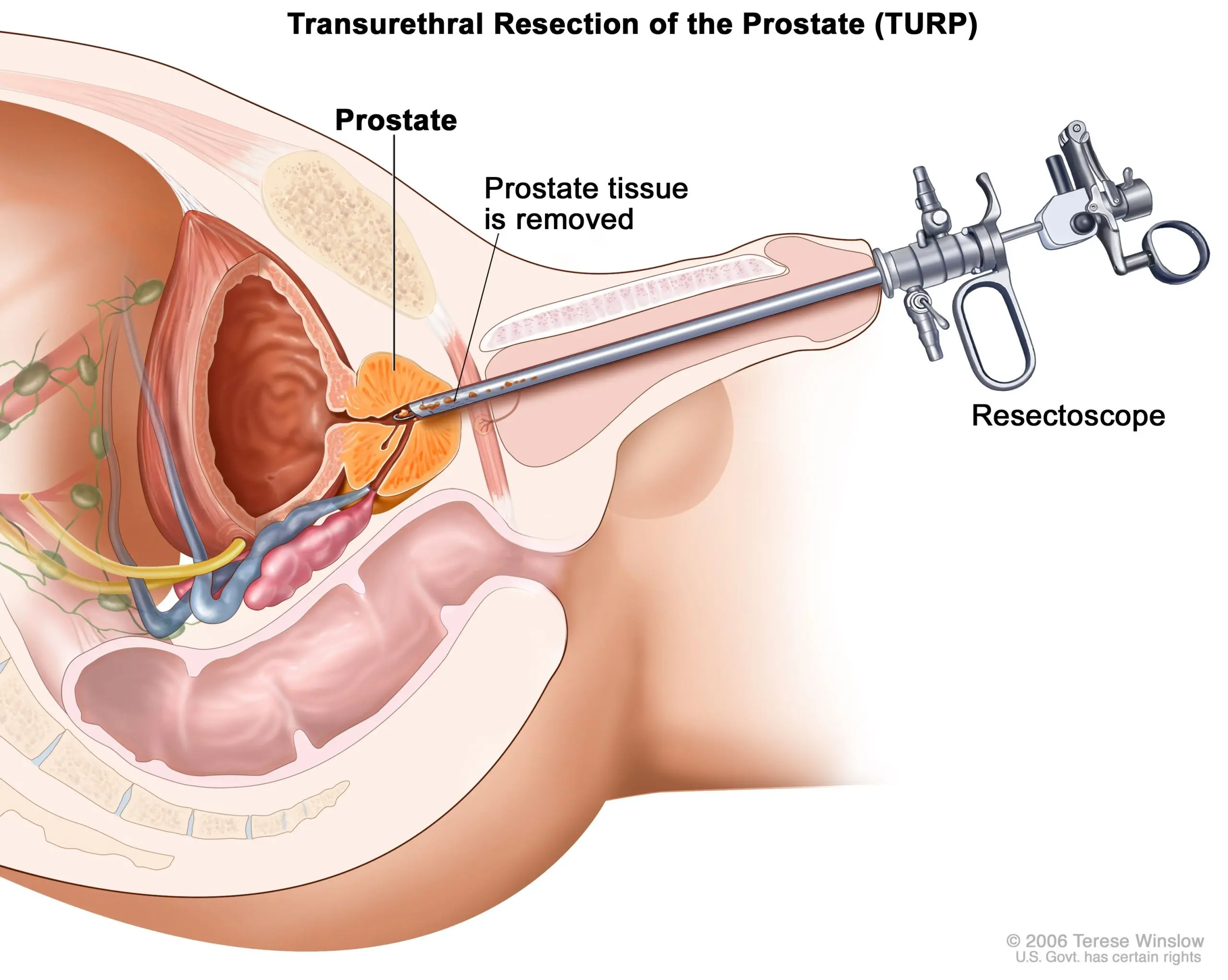 I was diagnosed with prostate cancer. How will I be treated?