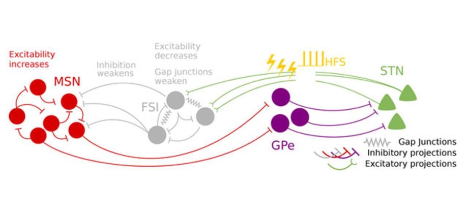 In Poland, 100 people suffer from Parkinson&#8217;s disease. people. Deep brain stimulation can help