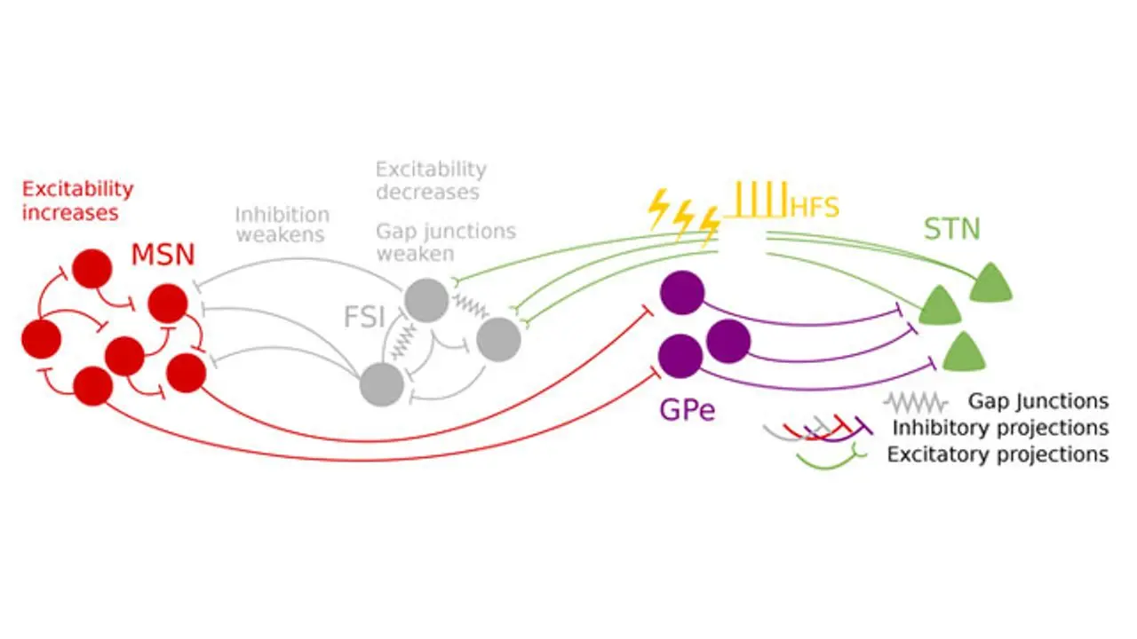 In Poland, 100 people suffer from Parkinson&#8217;s disease. people. Deep brain stimulation can help