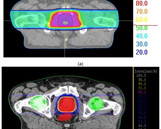 «In Poland, patients with prostate cancer have access to all treatment methods. Unfortunately, not all treatments are free »