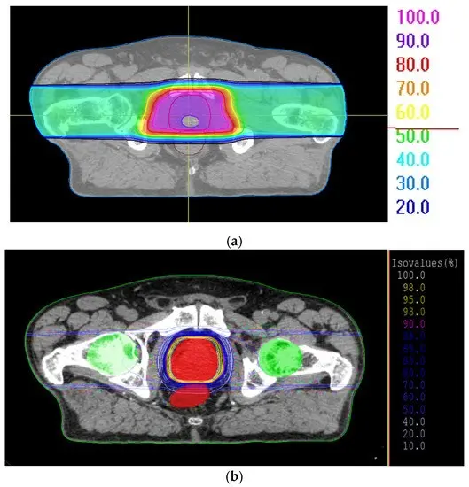 «In Poland, patients with prostate cancer have access to all treatment methods. Unfortunately, not all treatments are free »