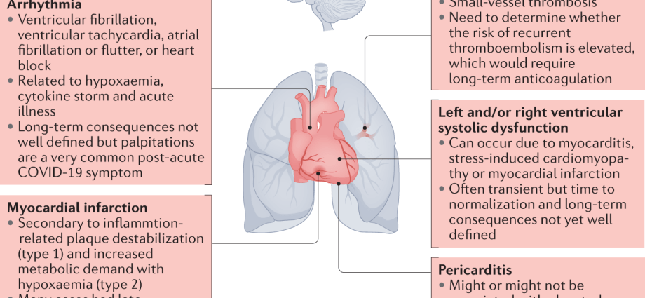 In young people, even mild COVID-19 can lead to long-term heart problems