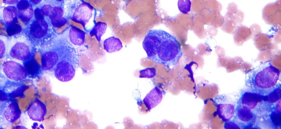 Incorrectly performed cytology