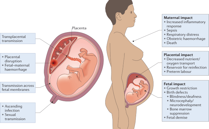 Infectious diseases of the mother during pregnancy, affecting the development of the fetus