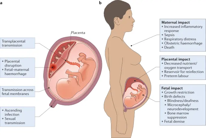 Infectious diseases of the mother during pregnancy, affecting the development of the fetus