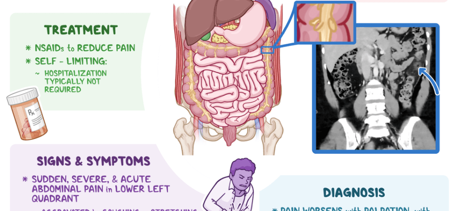 Inflammation of the appendages &#8211; symptoms, treatment